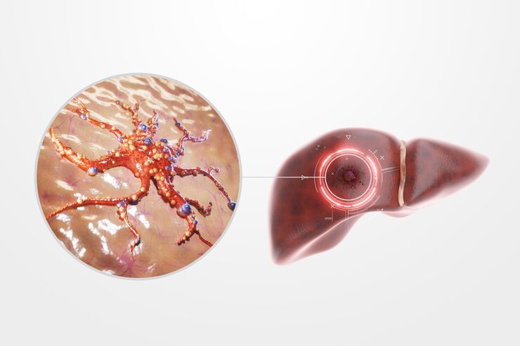 liver