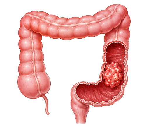 colon