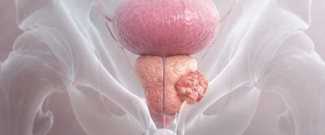 prostate