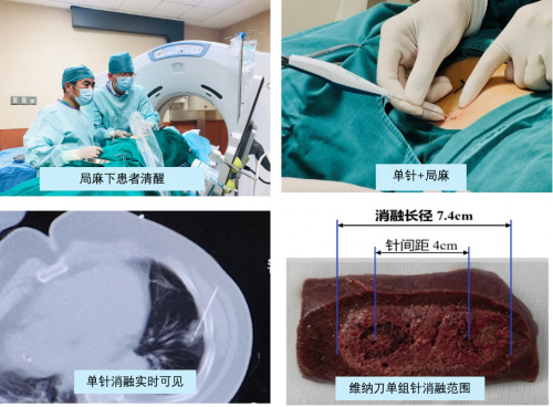 维纳刀