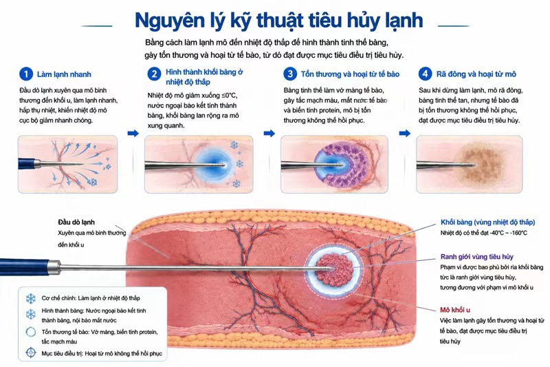 Tiêu hủy bằng áp lạnh