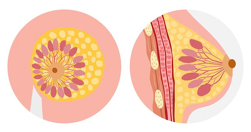 breast cancer image