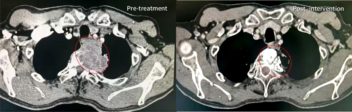 CT scans